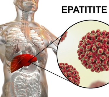 Epatite B (HBV)